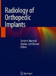Radiology of Orthopedic Implants