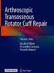 Arthroscopic Transosseous Rotator Cuff Repair
