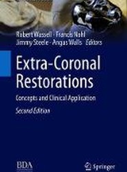 Extra-Coronal Restorations