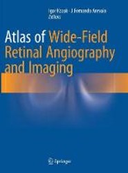 Atlas of Wide-Field Retinal Angiography and Imaging