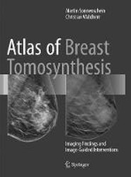 Atlas of Breast Tomosynthesis