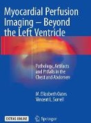 Myocardial Perfusion Imaging - Beyond the Left Ventricle