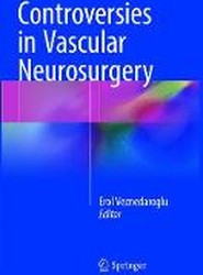 Controversies in Vascular Neurosurgery