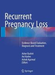Recurrent Pregnancy Loss