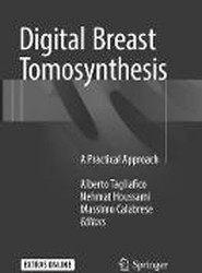 Digital Breast Tomosynthesis