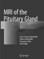 MRI of the Pituitary Gland