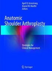 Anatomic Shoulder Arthroplasty