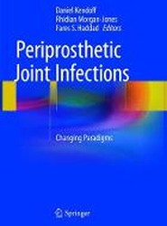 Periprosthetic Joint Infections