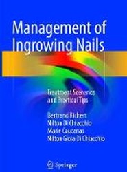 Management of Ingrowing Nails