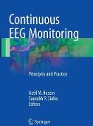 Continuous EEG Monitoring