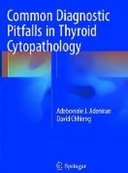 Common Diagnostic Pitfalls in Thyroid Cytopathology
