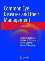 Common Eye Diseases and their Management