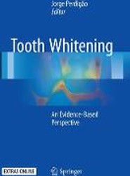 Tooth Whitening