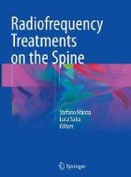 Radiofrequency Treatments on the Spine
