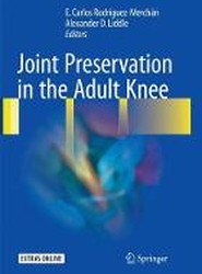 Joint Preservation in the Adult Knee