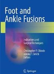 Foot and Ankle Fusions