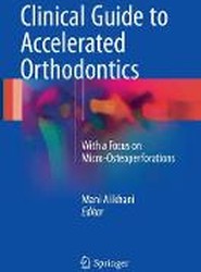 Clinical Guide to Accelerated Orthodontics