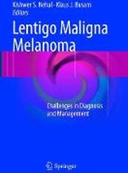 Lentigo Maligna Melanoma