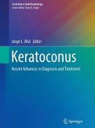 Keratoconus