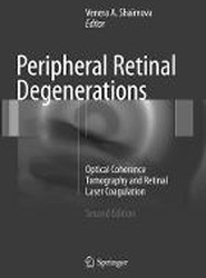 Peripheral Retinal Degenerations