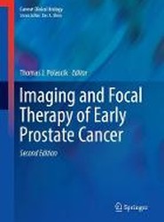 Imaging and Focal Therapy of Early Prostate Cancer