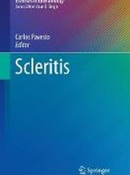 Scleritis