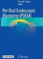 Per Oral Endoscopic Myotomy (POEM)