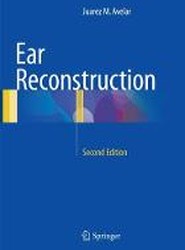 Ear Reconstruction