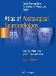 Atlas of Postsurgical Neuroradiology