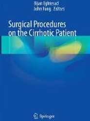 Surgical Procedures on the Cirrhotic Patient