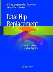 Total Hip Replacement