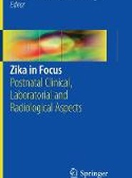 Zika in Focus