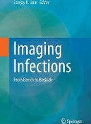 Imaging Infections