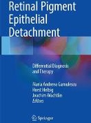 Retinal Pigment Epithelial Detachment