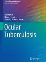 Ocular Tuberculosis