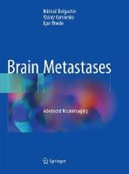 Brain Metastases