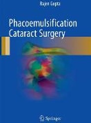 Phacoemulsification Cataract Surgery