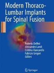 Modern Thoraco-Lumbar Implants for Spinal Fusion
