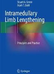 Intramedullary Limb Lengthening