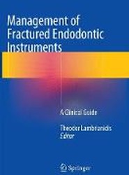 Management of Fractured Endodontic Instruments
