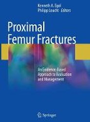 Proximal Femur Fractures