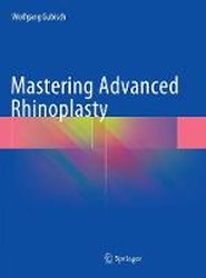 Mastering Advanced Rhinoplasty