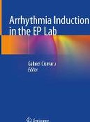 Arrhythmia Induction in the EP Lab