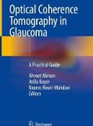 Optical Coherence Tomography in Glaucoma