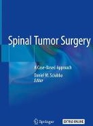 Spinal Tumor Surgery
