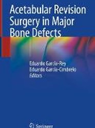 Acetabular Revision Surgery in Major Bone Defects