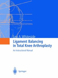 Ligament Balancing in Total Knee Arthroplasty