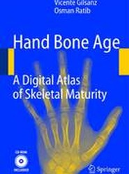 Hand Bone Age