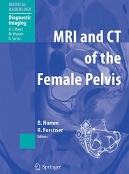 MRI and CT of the Female Pelvis