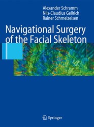 Navigational Surgery of the Facial Skeleton